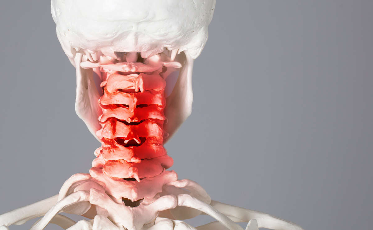 Whiplash Injuries Cervical Facet Joints